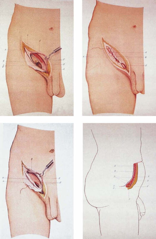 bassini_ilustraciones