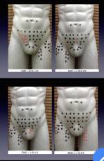 mapeo inguinal