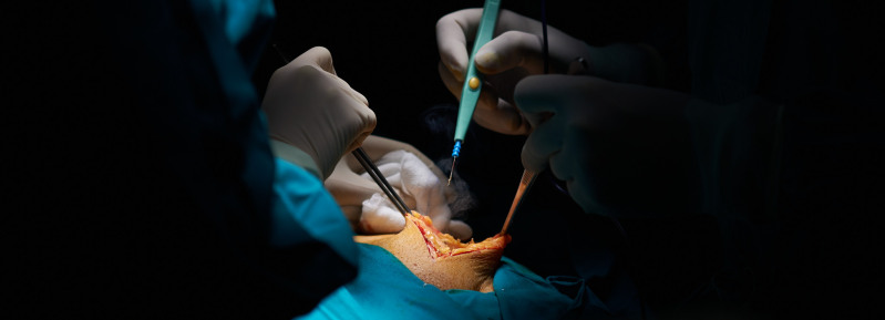 imagen cirugía abierta