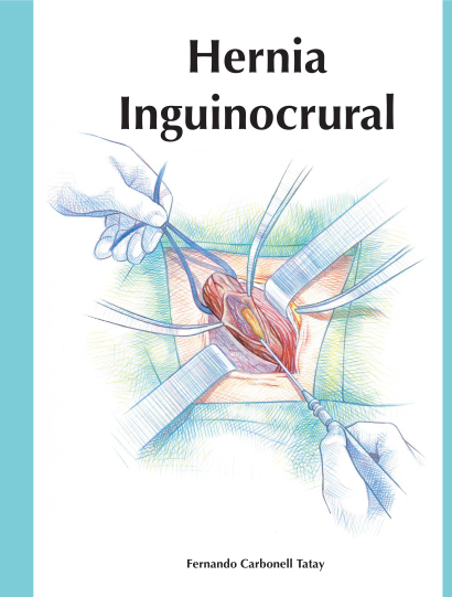 portada libro hernia inguinocrural (2000)